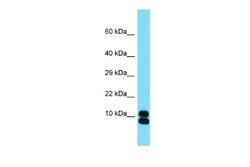 RPL35 Rabbit anti-Mouse, Polyclonal, Novus Biologicals 0.1 mL | Buy Online | Novus Biologicals | Fisher Scientific